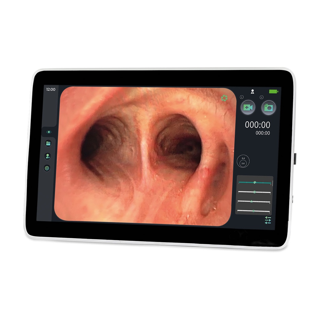 EickView SD Monitor de endoscopia pantalla táctil de 15,6"