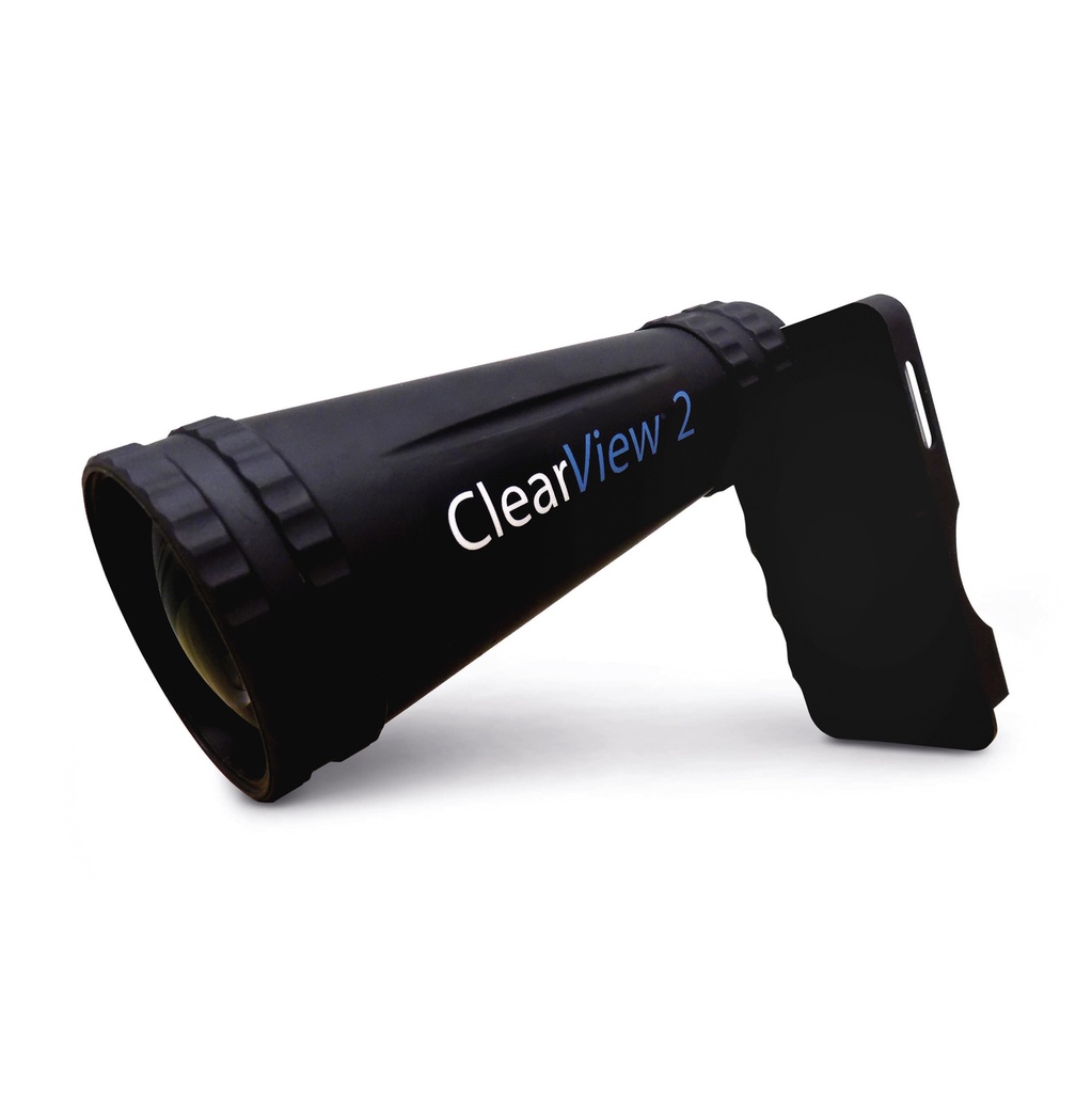 Caméra CLEARVIEW 2 pour l'examen du fond de l'œil avec iPod touch