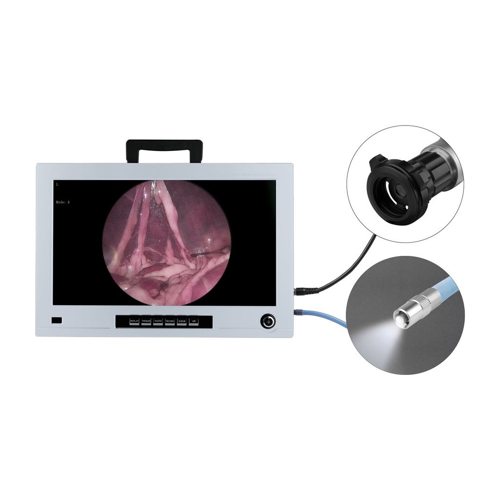 EickView monitor de endoscopia 4 en 1con cámera CCD de alta resolución yfuente de luz fría LED
