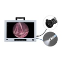 Endoskopie Monitor 22", Full HD mit integrierter CCD Kamera und Lichtquelle