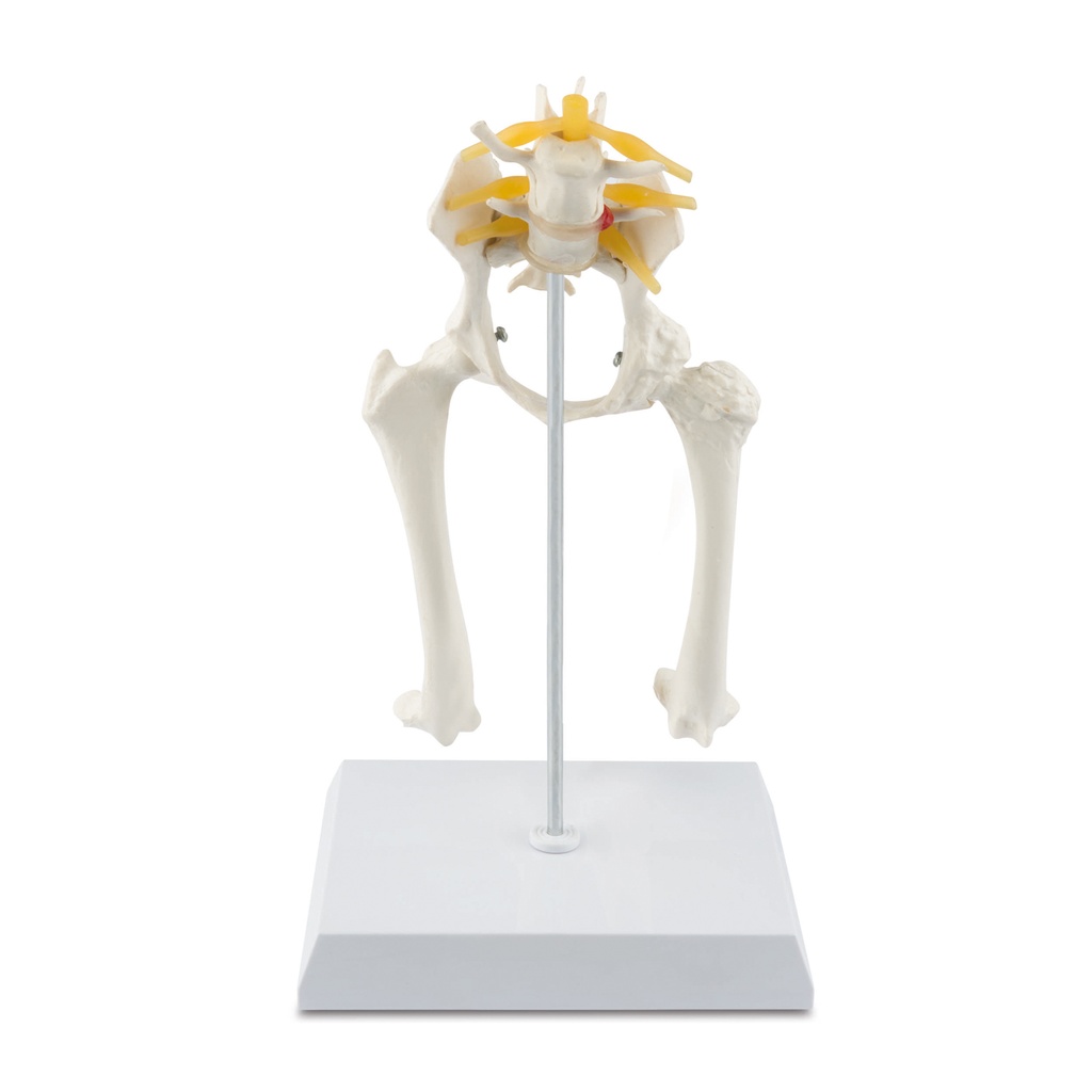 Osteo-Modell Typ: Hüfte  
