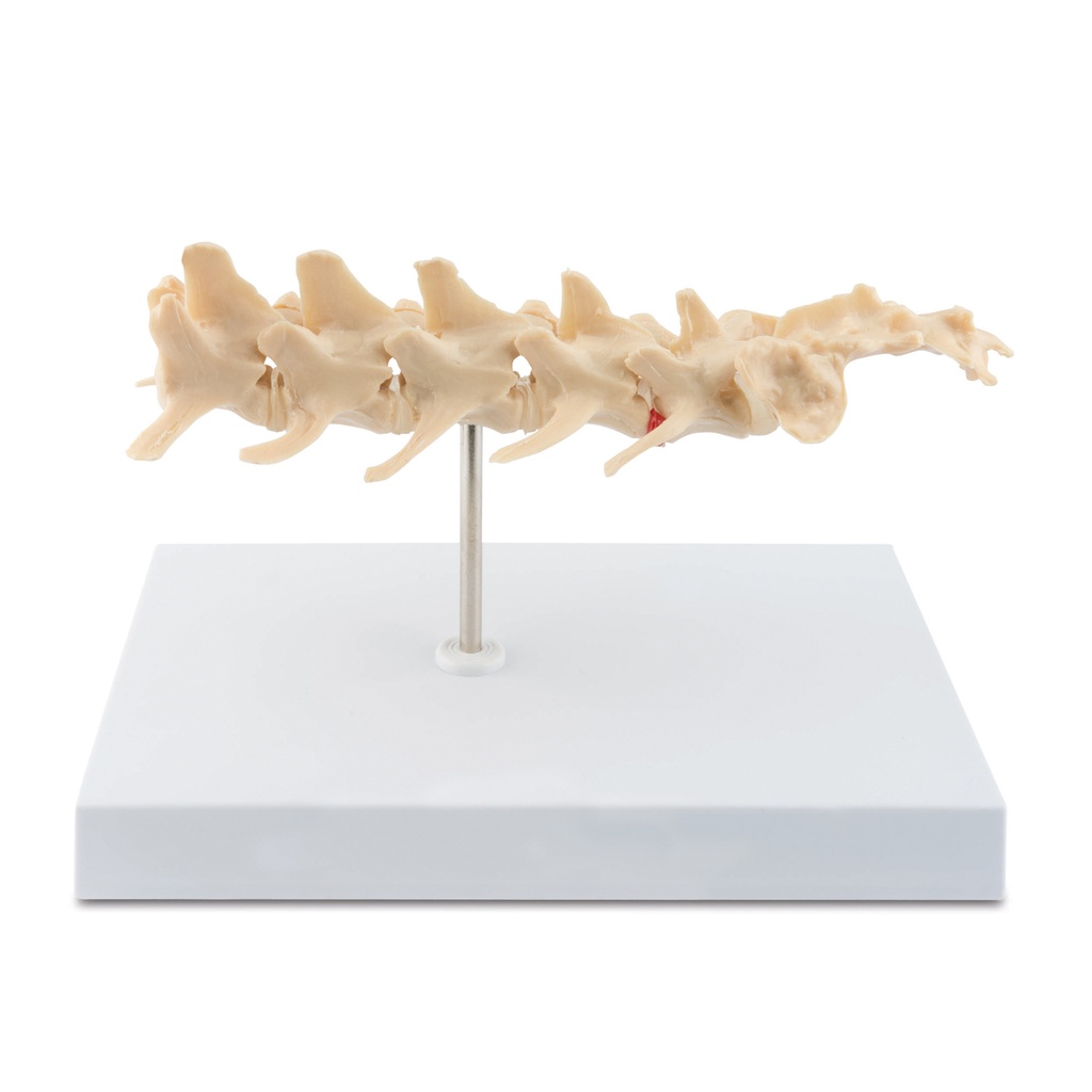 Osteo-Modell Typ: Wirbelsäule  