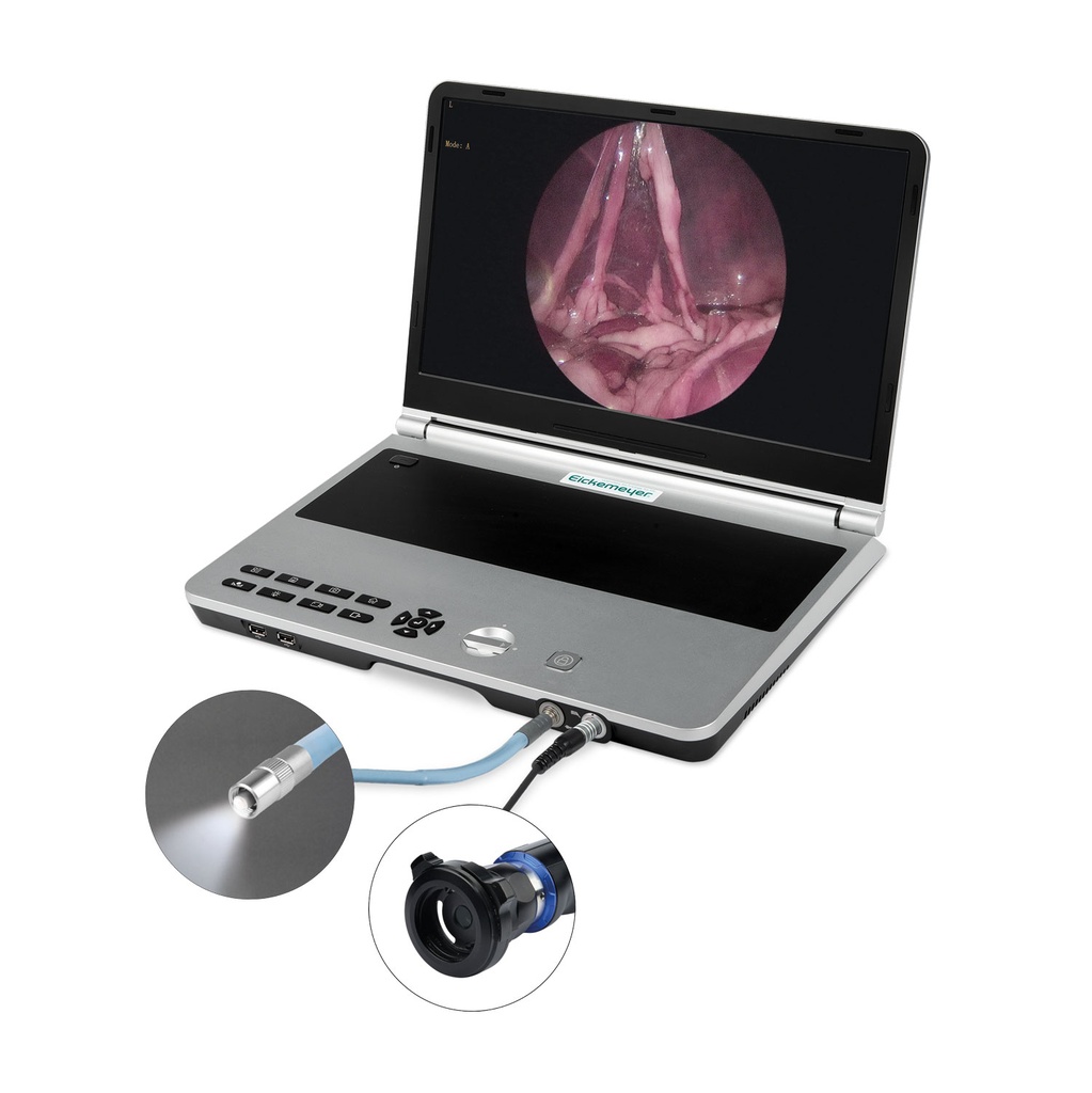 Sistema de endoscopia compacto EickView 4 en 1