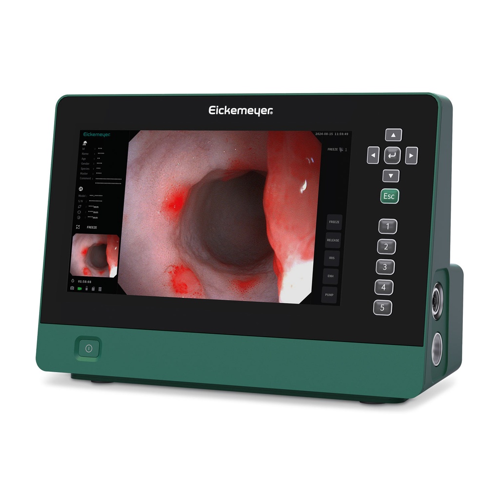 EickView 5 en 1 sistema de endoscopia